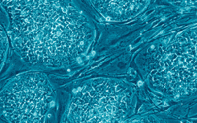 The genetic sergeants that keep stem cells stemmy